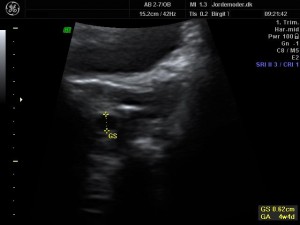 Scanning gravid uge 5