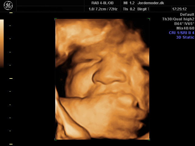 Scanning gravid uge 39